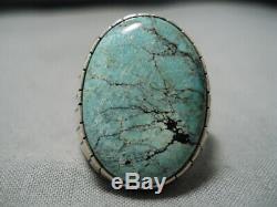 Incredible Vintage Navajo Green Turquoise Sterling Silver Native American Ring
