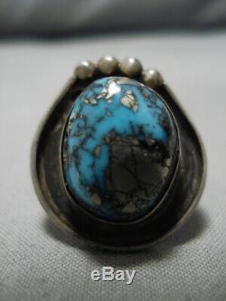 Striking Vintage Navajo Old Morenci Turquoise Sterling Silver Ring Old